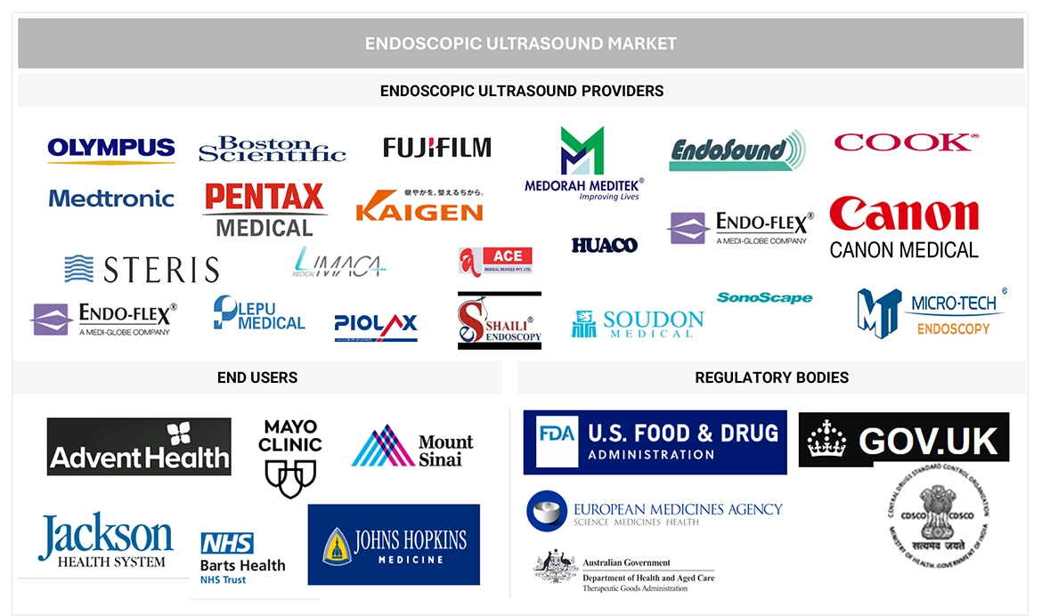 超音波内視鏡（EUS）市場 – 2029年までの世界予測