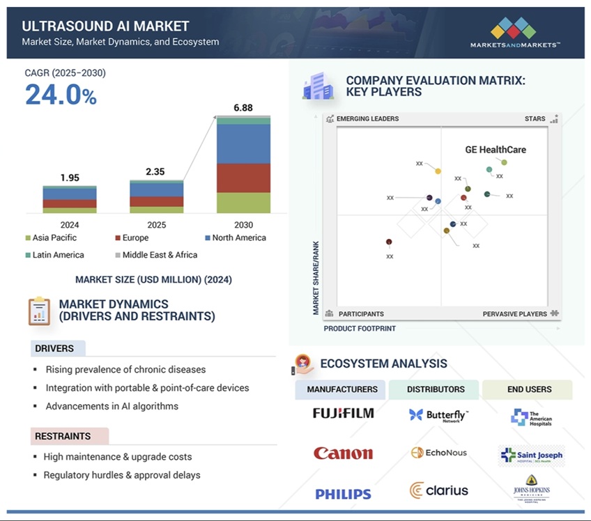 超音波AI市場規模、シェア、動向、2030年までの世界予測